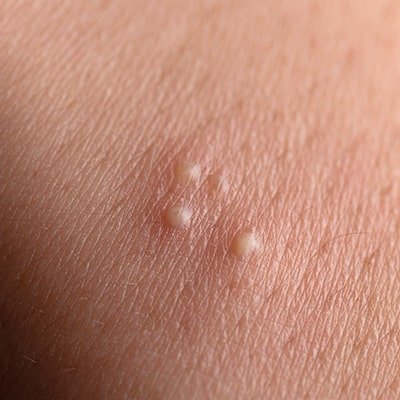 Dermatologista