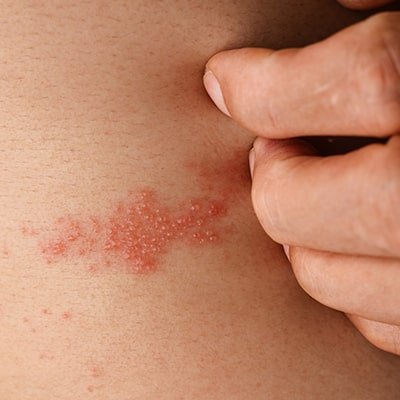 Dermatologista